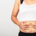 How to reduce scarring after Gastric Sleeve surgery